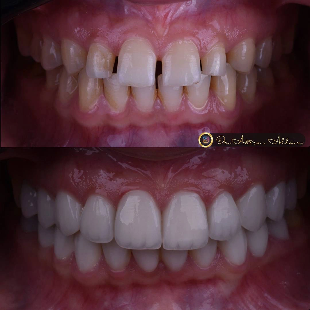 Amira Intraoral